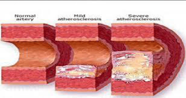 acst-aid1004-g007