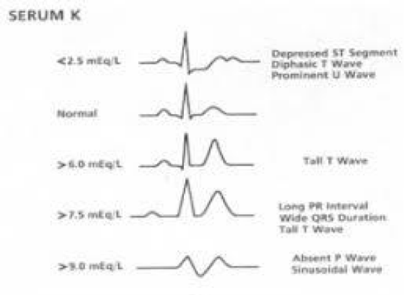 acst-aid1004-g009