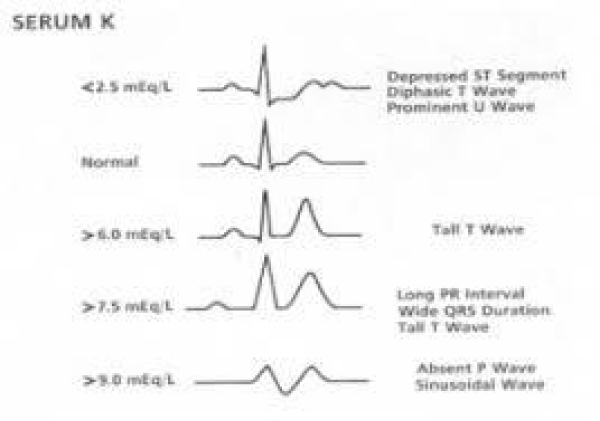 acst-aid1004-g010