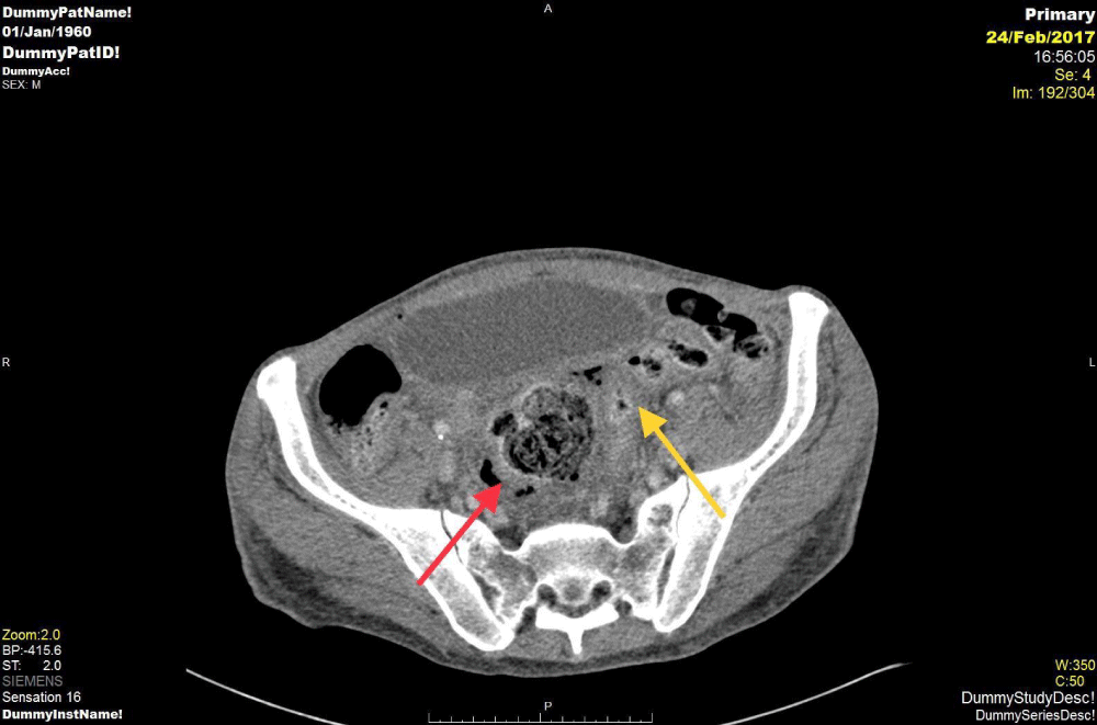 acst-aid1009-g002