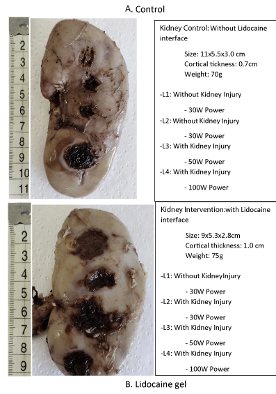 acst-aid1017-g001