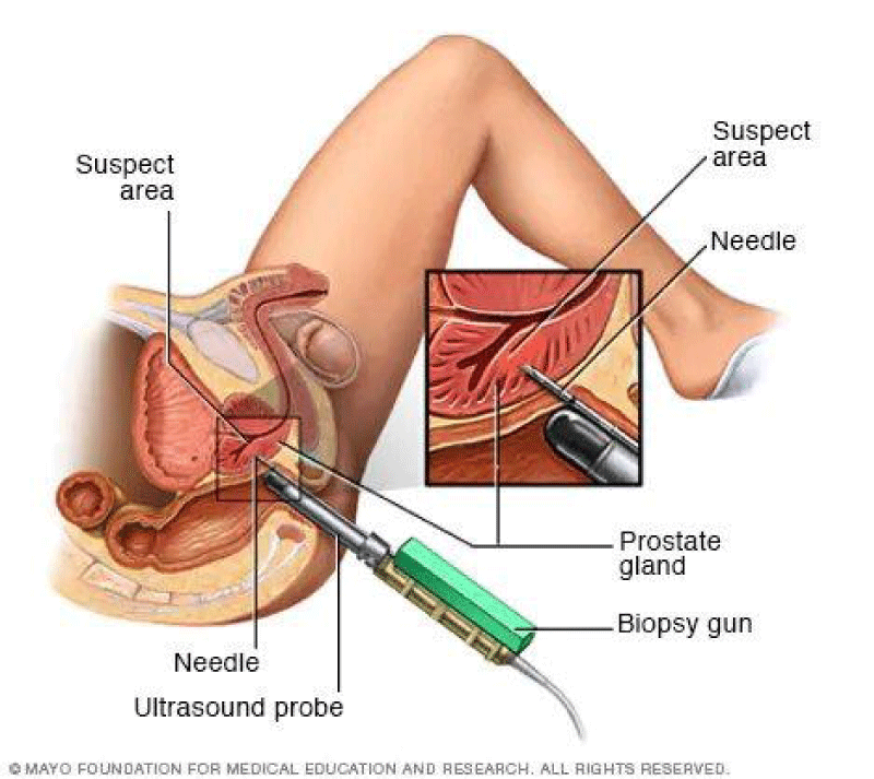 acst-aid1028-g003